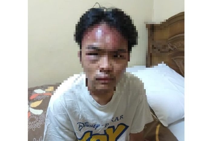 Mahasiswa asal Kudus yang kader NU dikeroyok mahasiswa WNI di Mesir